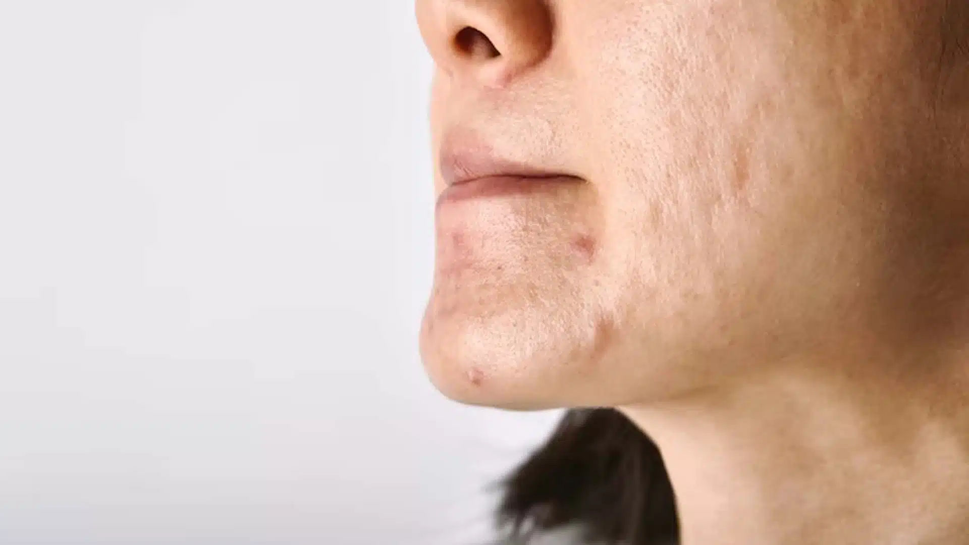 مشکلات پوستی
